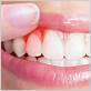 gum disease treatments arlington heights