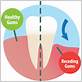 gum disease treatments crystal river