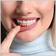 gum disease treatments escondido