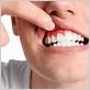 gum disease treatments in beaumont