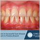 gum disease treatments in buford