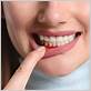 gum disease treatments in carlsbad