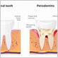 gum disease treatments in imperial