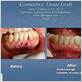 gum disease treatments in livonia