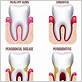 gum disease treatments in memphis