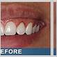 gum disease treatments in santa cruz