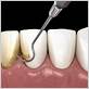 gum disease treatments in south glastonbury