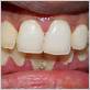 gum disease treatments in vienna