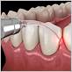 gum disease treatments london