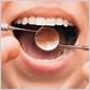 gum disease treatments madison
