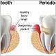 gum disease treatments manassas