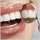 gum disease treatments salinas
