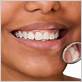 gum disease treatments south glastonbury