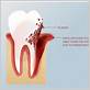 gum disease treatments tracy