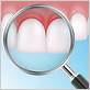 gum disease treatments woodland hills