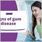 gum disease tri-cities