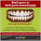 gum disease turn your teeth black