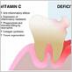 gum disease vitamin c