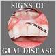 gum disease waco tx