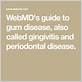 gum disease webmd