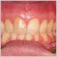 gum disease westerly ri
