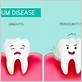 gum disease what to avoid