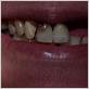 gum disease woodstock on
