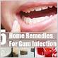 gum inflammation treatment at home