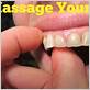gum massage for periodontal disease