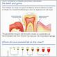 gum recession numbers