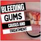 gums bleeding treatment