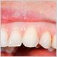 gums light pink around teeth