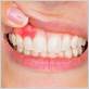 gums sore after using waterpik