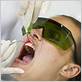 has laser-gum disease fresno http www.smilesbynoel.com zoom and lasersmile