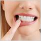 healing gum disease scottsdale az