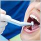 high pressure water teeth cleaning dentist