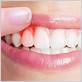 holland mi gum disease treatment