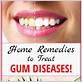 home remedy for gum disease and bad breath