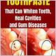 homemade toothpaste gum disease