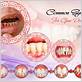 homeopathy treatment for gum disease