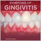 how bad is gingivitis