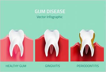 how can i fix gum disease