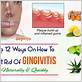 how can i get rid of gingivitis fast