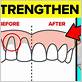 how can i strengthen my gums