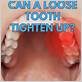 how can i tighten loose teeth from gum disease