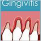 how can i treat gingivitis at home