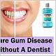 how can you cure gum disease without a dentist
