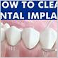 how do you clean dental implants