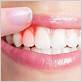 how does a holistic dentist deal with gum disease