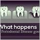 how long can gum disease go untreated